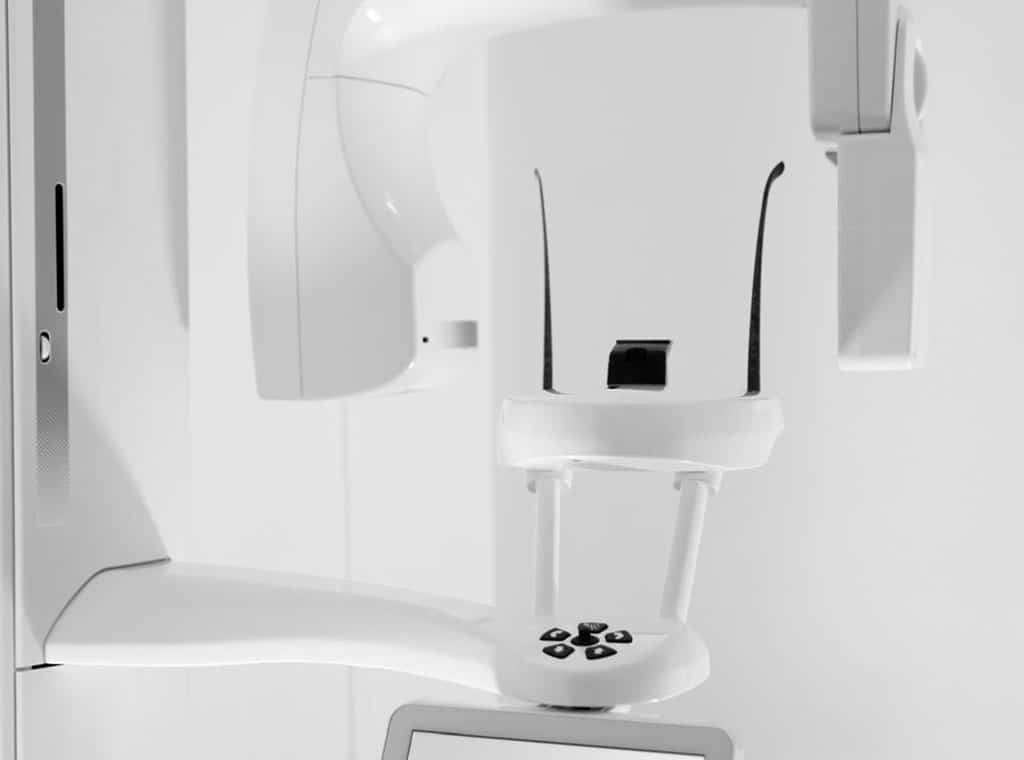 Tarif scanner 3D implantologie dentaire