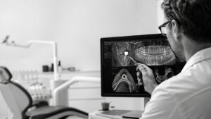 Implants dentaires sans vis