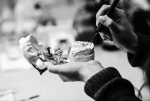 Prix implant dentaire en Belgique